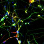 Stem cell and Regenerative cell treatments.