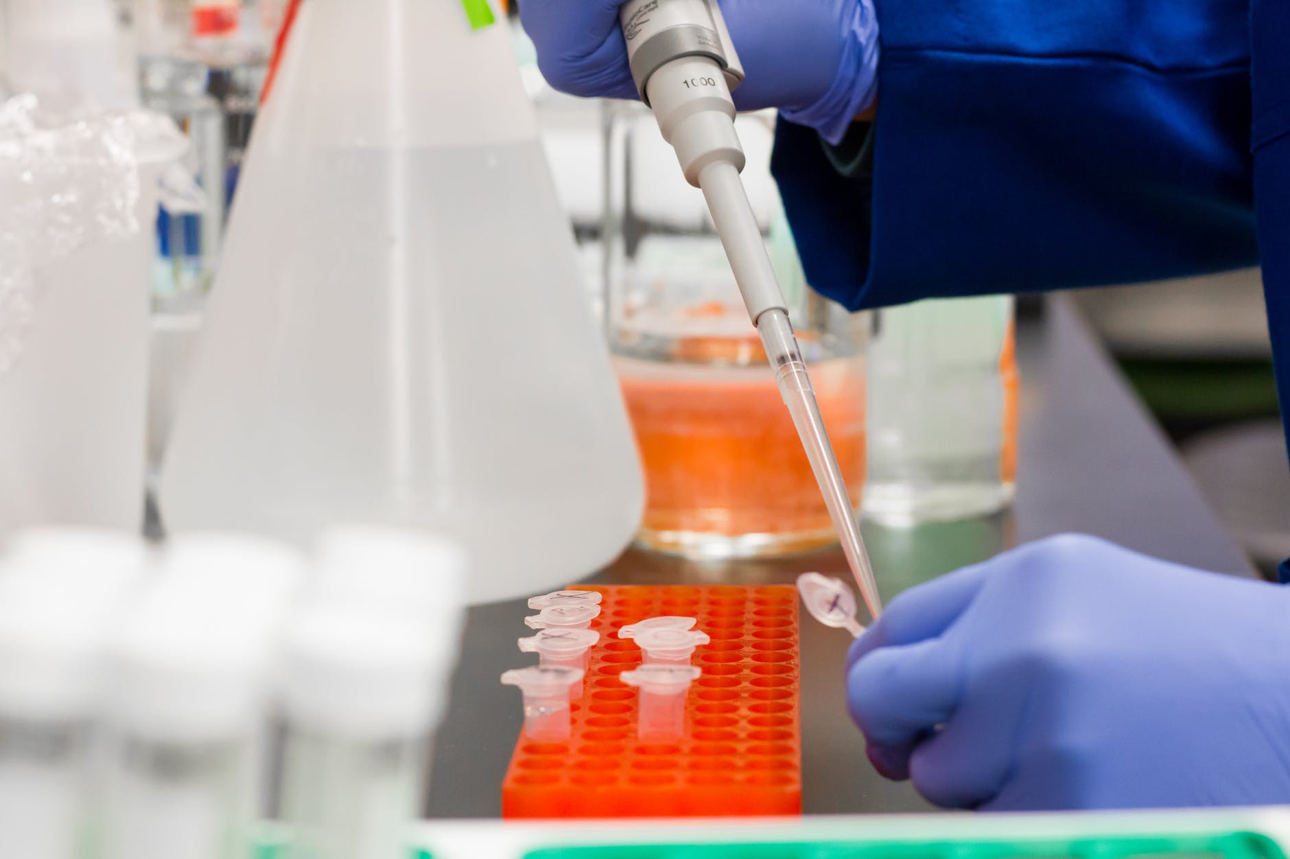 Stem Cells show promise in treating Coronavirus (COVID-19) associated Pneumonia