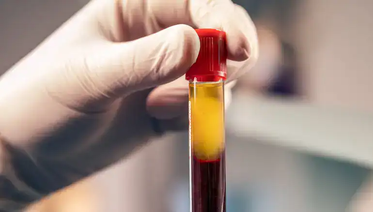 prp for erectile dysfunction Newport Beach