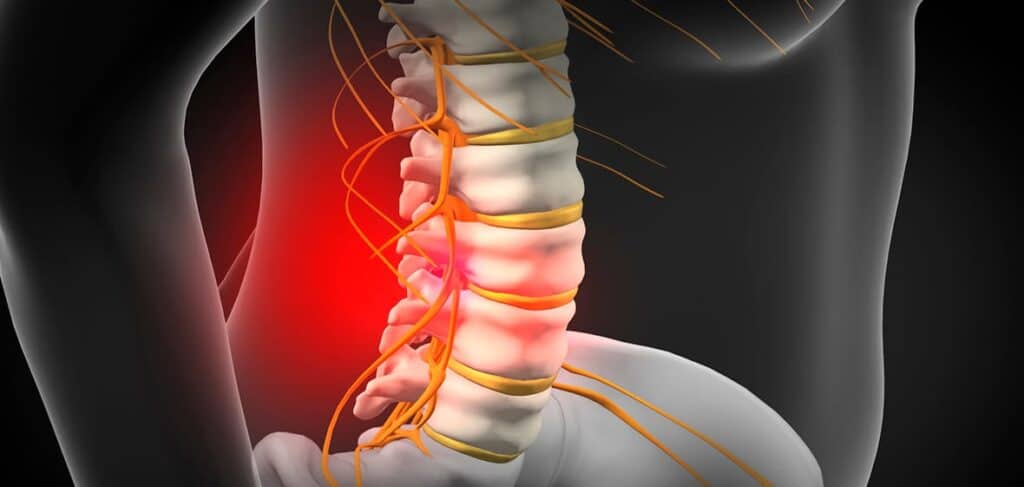 stem cell therapy for herniated disc success rate